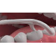 Флосс-зубочистки Комплексное очищение Задние зубы DenTek 75 шт. (44927)